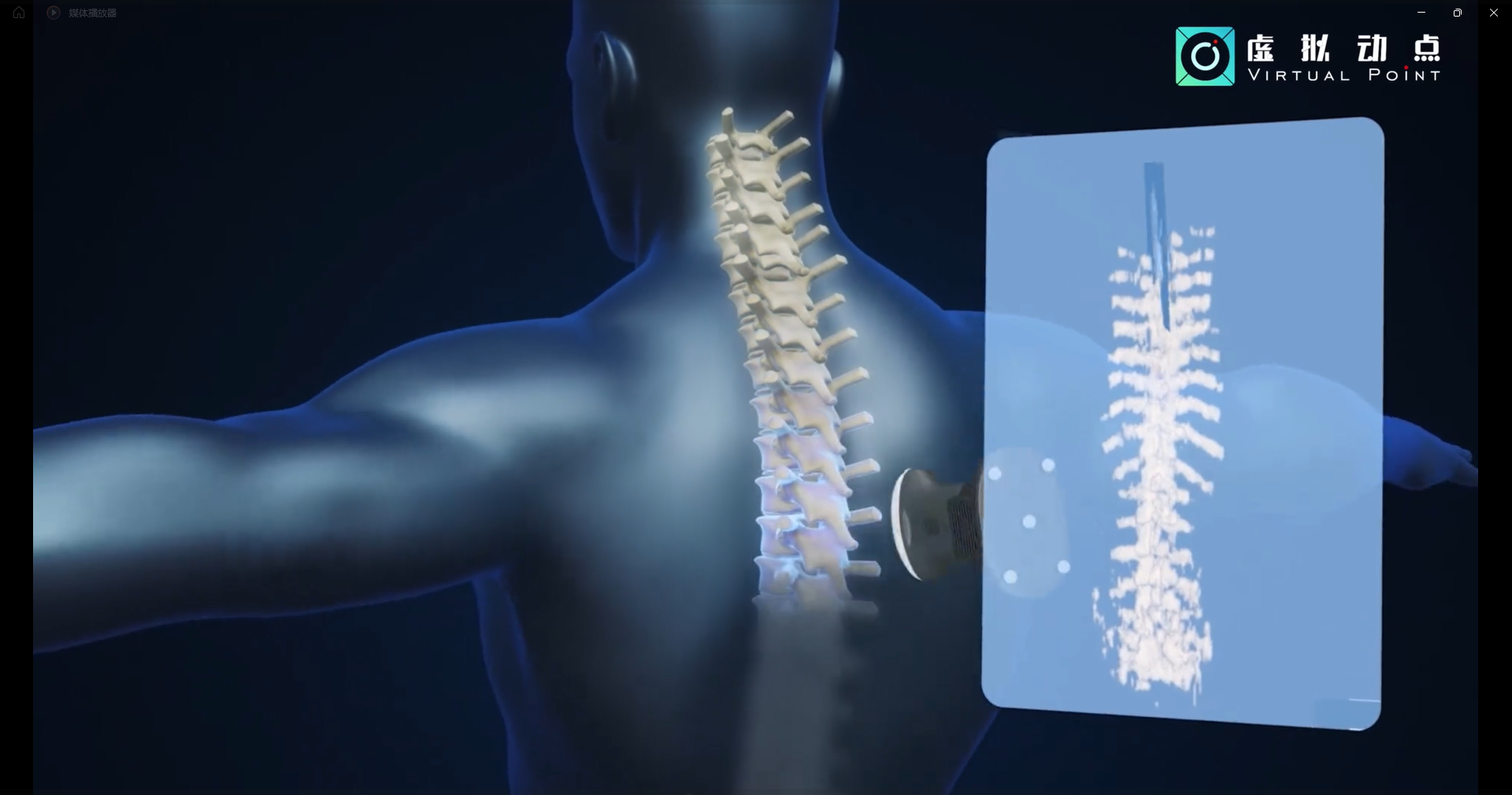 xcsport体育·虚拟动点OptiTrack开创3D超声成像在脊柱诊断中的应用